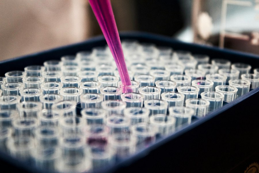 Uji Kromatografi Laboratorium BPOM